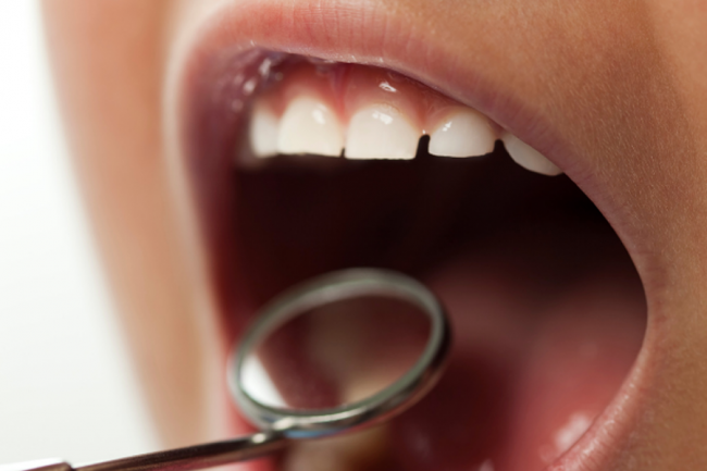 Pediatric Dentistry in Abu Dhabi